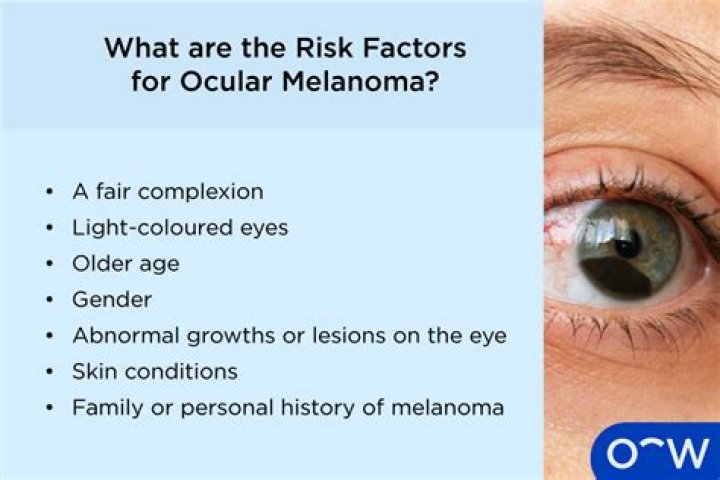 Can an optometrist diagnose ocular melanoma?