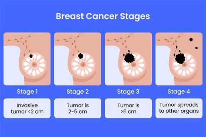 Can green tea cause breast cancer?