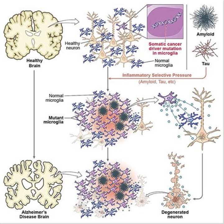 Is Alzheimer's inherited from the mother?