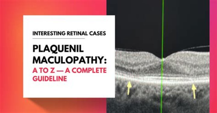 Is plaquenil used for RA?