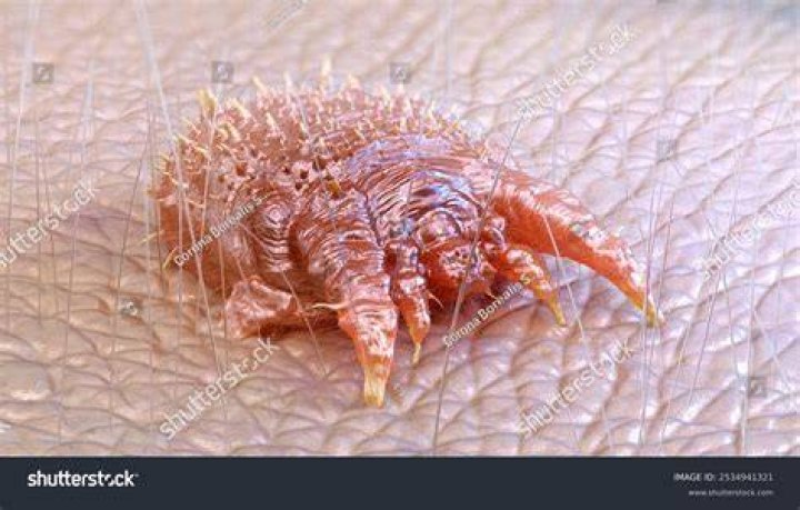 What are Scabie mites?
