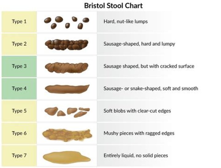 What dissolves impacted stool?