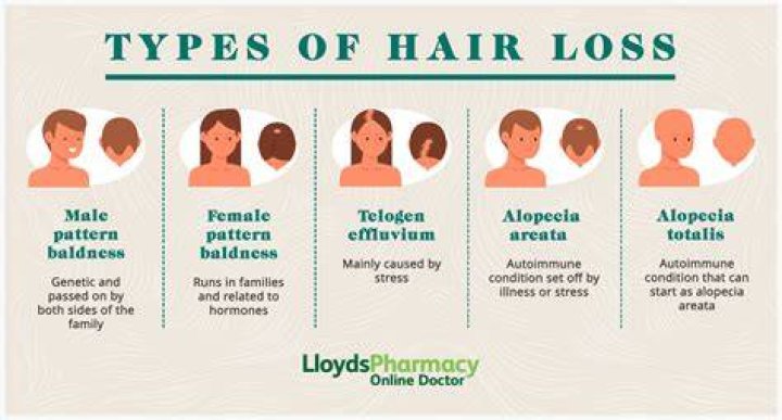 Why is my hair suddenly flat?