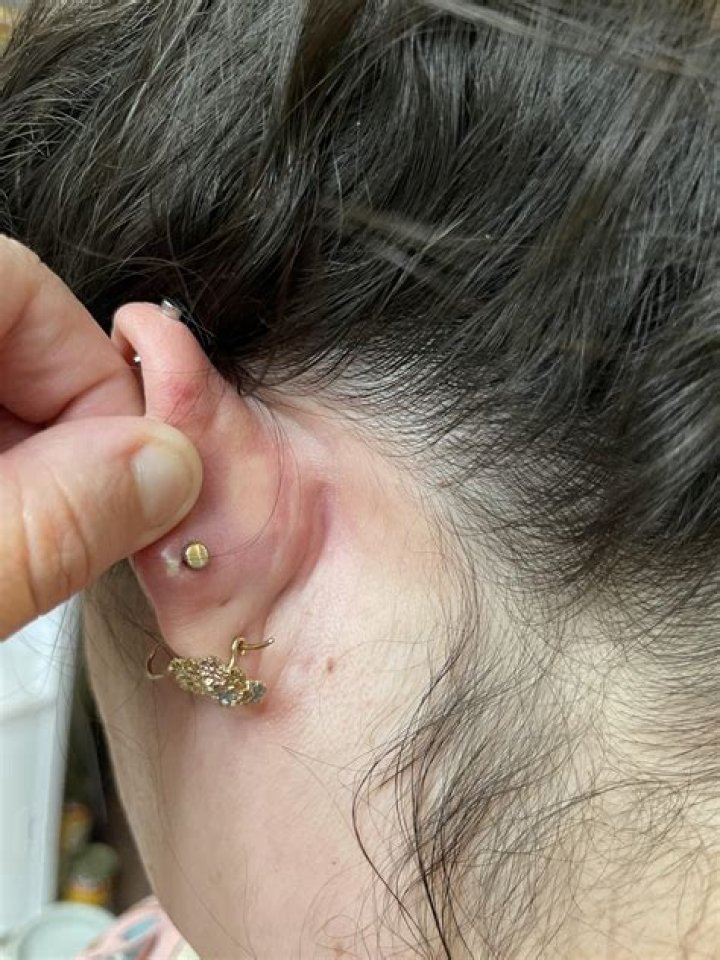 Why is there yellow crust on my piercing?